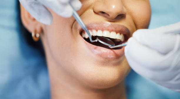 Best Emergency Dental Care for Abscessed Tooth in Fort Carson, CO